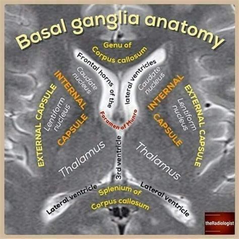 Basal ganglia anatomy... - Radiology Students Of A.M.S