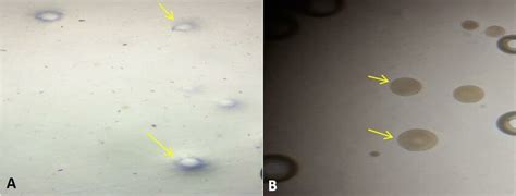 Two types of colony morphology. | Download Scientific Diagram