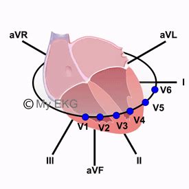 Correlation between Heart Walls and EKG Leads