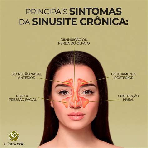 Principais sintomas da Sinusite Crônica | A sinusite crônica tem grande ...