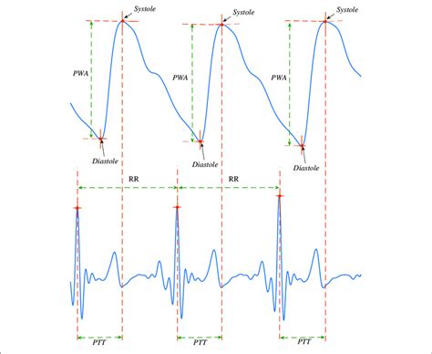 | Feature (Systole, Diastole, PWA and PTT) extraction from ...