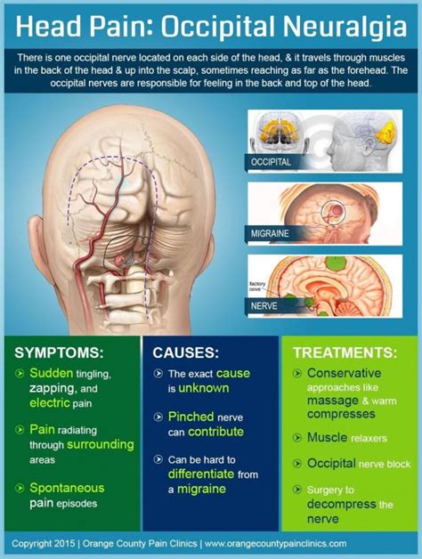 Pin on Back pain