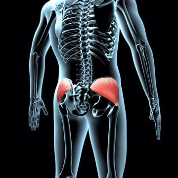 Gluteus Medius Trigger Points - What They Are And How To Release Them