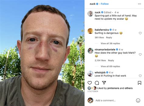 Accident-prone Mark Zuckerberg reveals "multiple surfing injuries ...