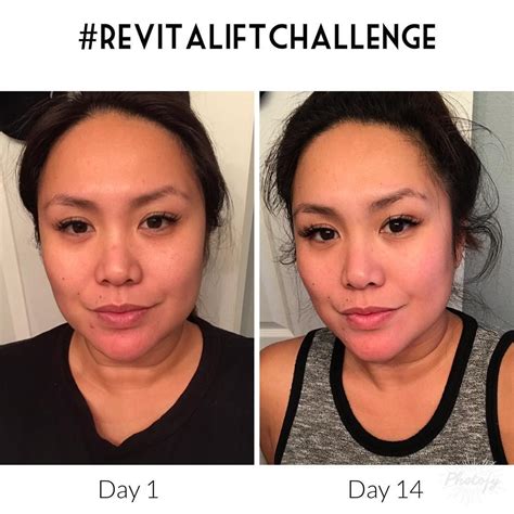 Loreal Revitalift Challenge skin results, before and after. Loreal ...