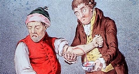 The Gross History Of Bloodletting And Medicine By Leeches