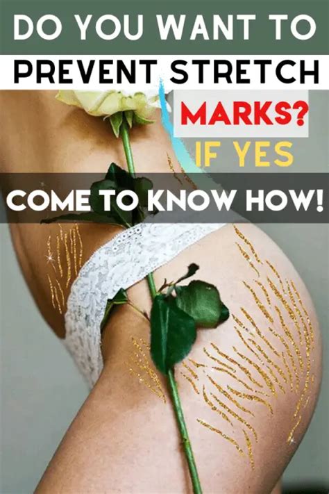 HOW TO PREVENT STRETCH MARKS? – Mum and Them