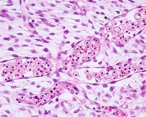 Endothelium Histology