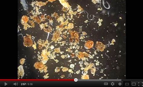 Video: See Soil Microfauna Up Close | DeepRoot Blog