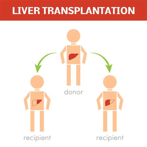 Liver Cancer Treatment - Anti Leukemia