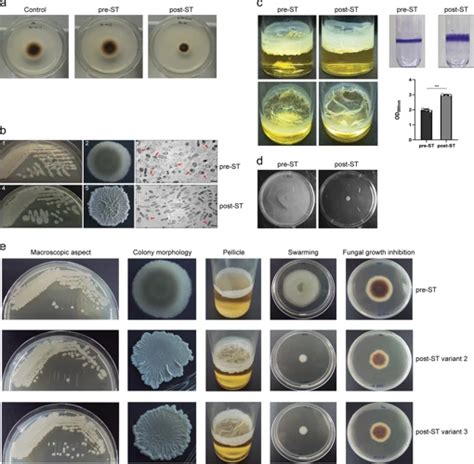 How to Differentiate Between Bacteria and Fungus Under the Microscope