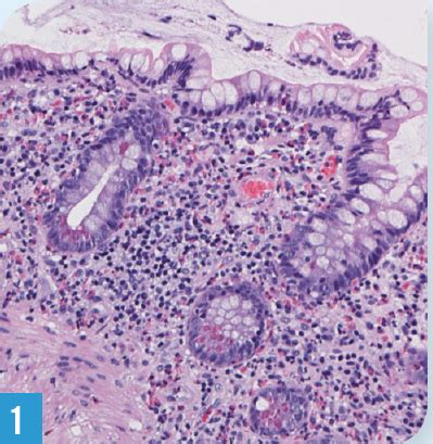 How Would You Diagnose this Infection? | Consultant360