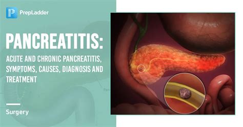 Pancreatitis: Acute And Chronic Pancreatitis, Symptoms, Causes, Diagnosis and Treatment
