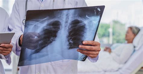 Miliary TB: Differential Diagnosis, Vs. Pulmonary Tuberculosis, More