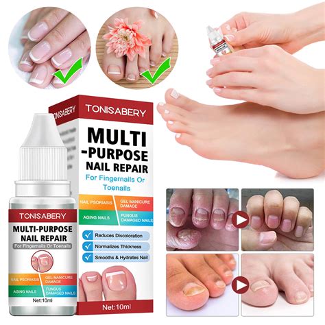 Igh Penetration, No Irritation, Regrowth Of Nail Or Toenail.Nail Fungus ...