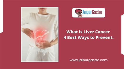 What is Liver Cancer - Symptoms, Causes and 4 Ways to Prevent.