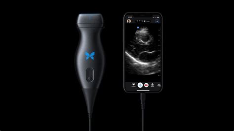 The world’s first portable full body ultrasound introduced by Butterfly Network (BFLY)