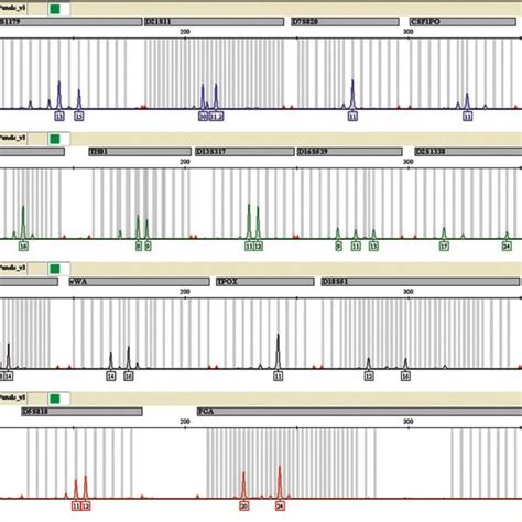 Electropherogram of DNA Extracted from Ex-1 using EZ1 DNA Extraction Method | Download ...