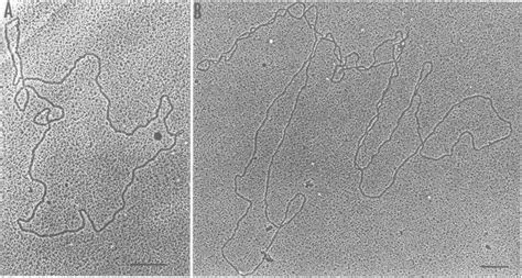 Electron micrographs of circular DNA molecules. The DNA was extracted ...