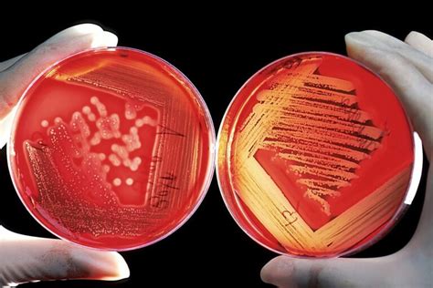 What are useful and harmful parabens in cosmetics and food products - ChemAlliance