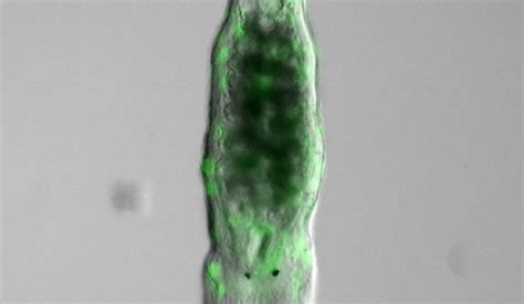 Tracking Microscopy - Cephla