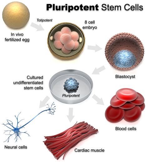 NEUMONÍA: STEM CELLS Y LA NEUMONÍA