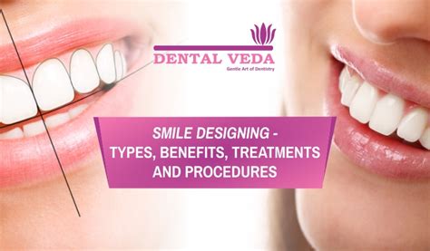 Smile Designing - Benefits and Treatments - Dental Veda