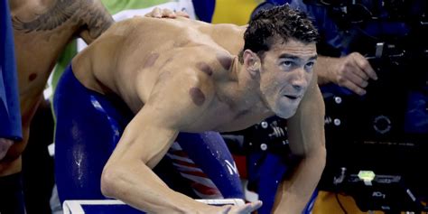 Michael Phelps' red circles from cupping therapy - Business Insider