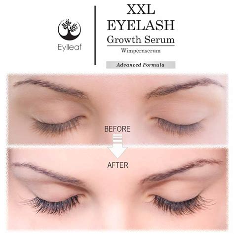 Diy Eyelash Growth Serum Before And After - Health Secrets: Latisse an easy to use lash serum ...