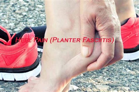 What is the Best Treatment for Heel Pain (Plantar Fasciitis)?