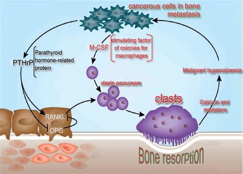 Neoplastic malignant cells release mediators that ease their... | Download Scientific Diagram