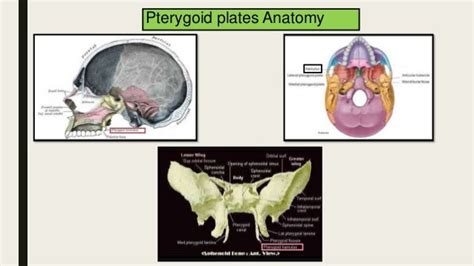 PTERYGOID HAMULUS SYNDROME- A CASE REPORT