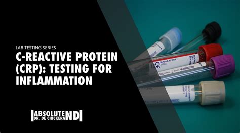 C-Reactive Protein (CRP): Testing for Inflammation | Dr Johann de Chickera ND