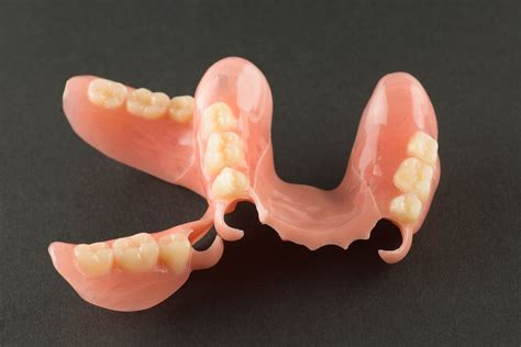 What Are Flexible Partial Dentures? - Sarasota Dentistry