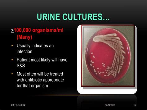 PPT - Interpretation of Urine Cultures PowerPoint Presentation - ID:212996