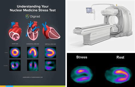 How Is A Nuclear Stress Test Done - Stress test von timothy f ...