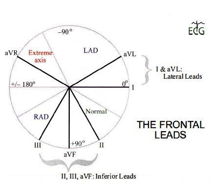 ECG-AXIS DETERMINATION - NeuroRehab.wiki