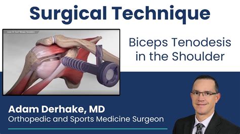 Biceps Tenodesis in the Shoulder: Surgical Technique - YouTube