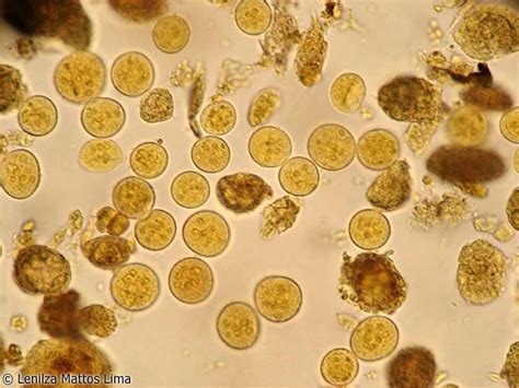 Entamoeba coli Cysts in feces | Medical Laboratories