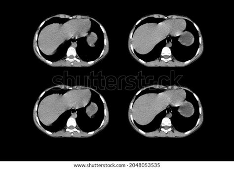 Chest Ct Scan Mri Images Stock Photo 2048053535 | Shutterstock