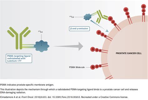 PSMA Emerges as Versatile Target in Prostate Cancer and Beyond Urology