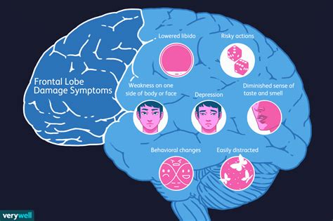 Can Frontal Lobe Damage Trigger Anger Issues? Exploring The Link