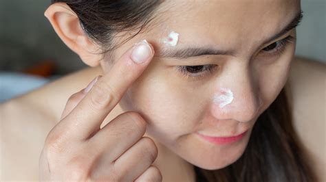 Benzoyl Peroxide vs. Salicylic Acid for Acne: Side Effects, Effectiveness, & More - GoodRx