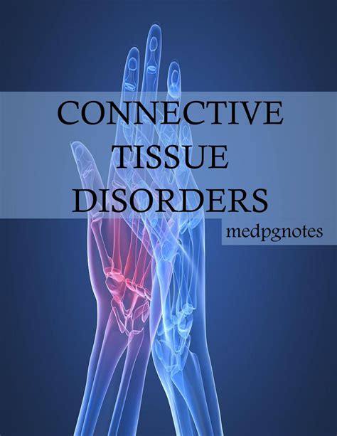 Connective tissue disorders sample