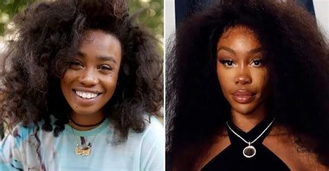 SZA Plastic Surgery: Singer Transformation | PlasticSurgeryInsights.com