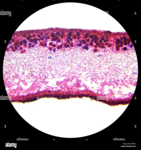 Foliose Lichen Under Microscope