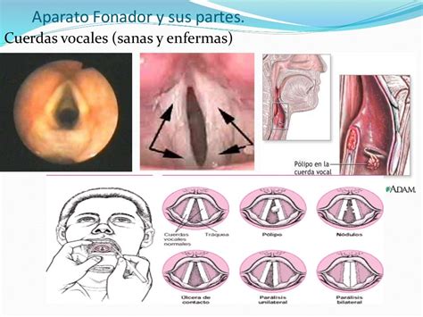 Aparato Fonador