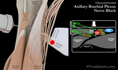 Axillary Nerve Block