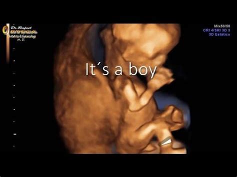 12weeks 3D ultrasound Can you tell the gender ? it´s a boy Rafael ...