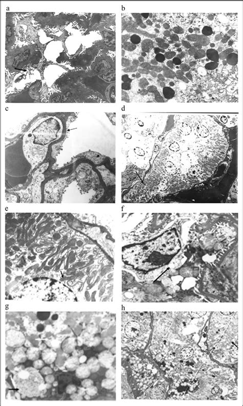 Figure 2 from Ultrastructural changes in the rat kidney after single ...